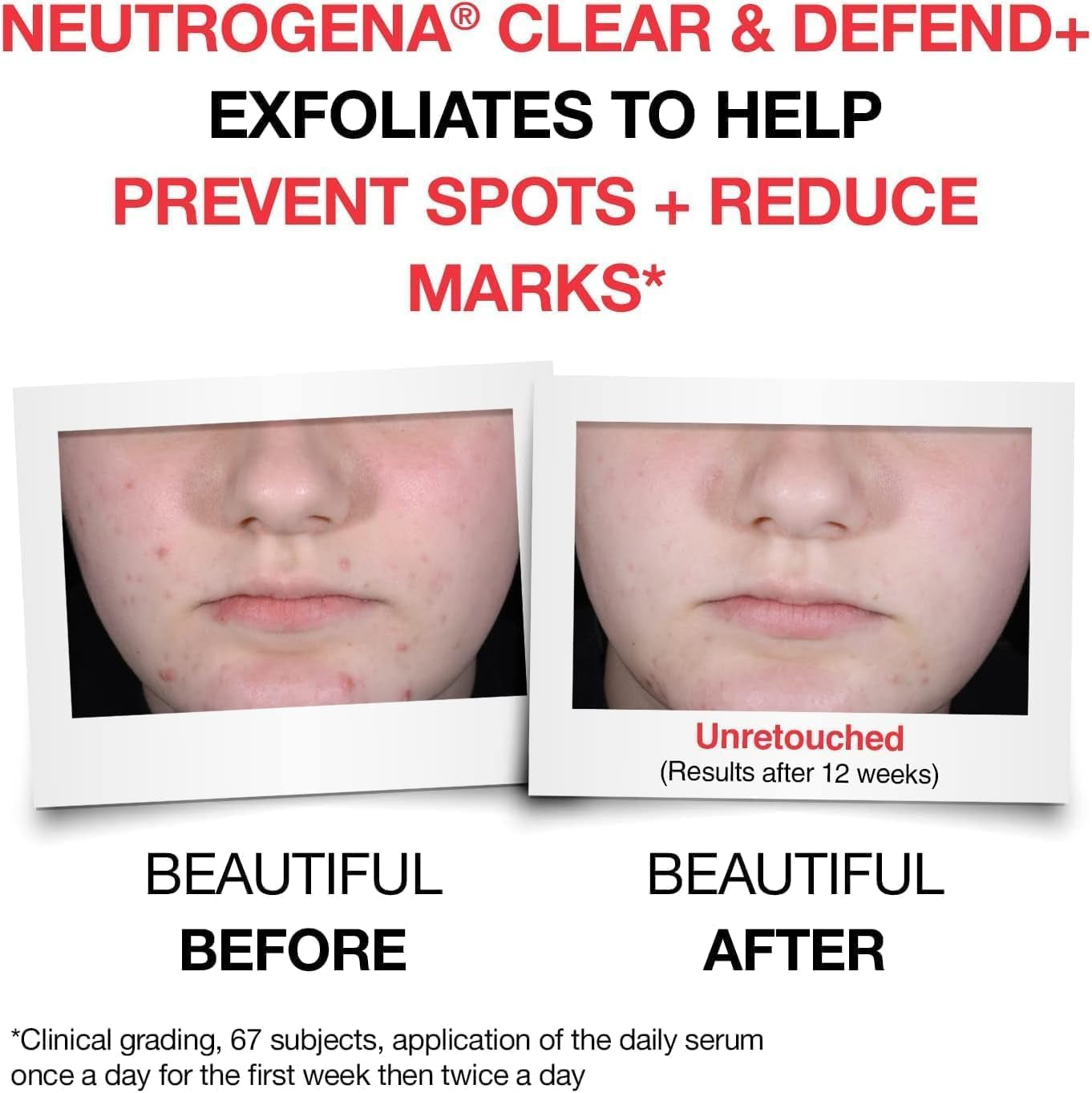 Clear & Defend+ 2-Step Skincare Set: Facial Wash & Serum for Spot-Prone Skin