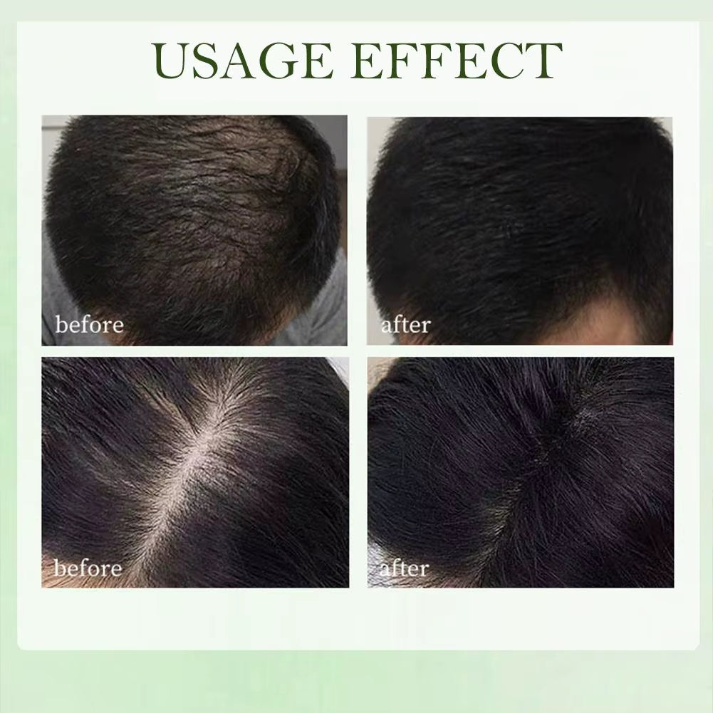 Grass & Platycladus Herbal Shampoo Soap Natural Hair Loss Treat