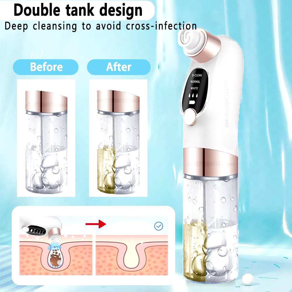 Blackhead Remover Pore Vacuum Face Cleaner Electric Pimple Acne Black Head Removal Rechargeable - EditWell
