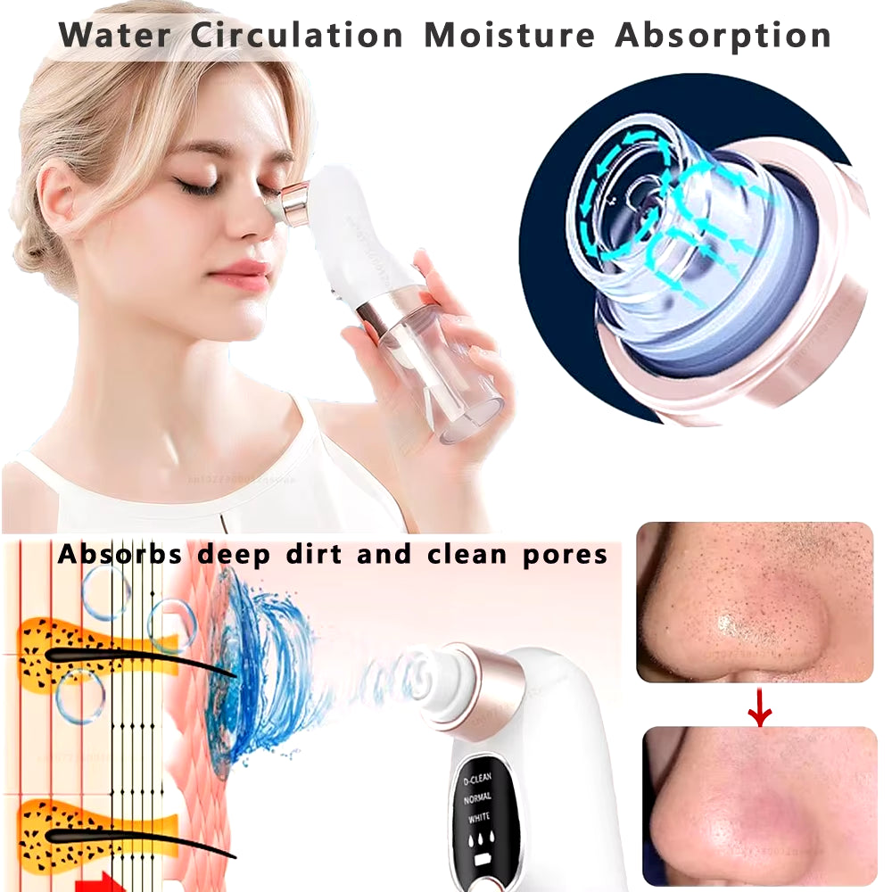 Blackhead Remover Pore Vacuum Face Cleaner Electric Pimple Acne Black Head Removal Rechargeable - EditWell