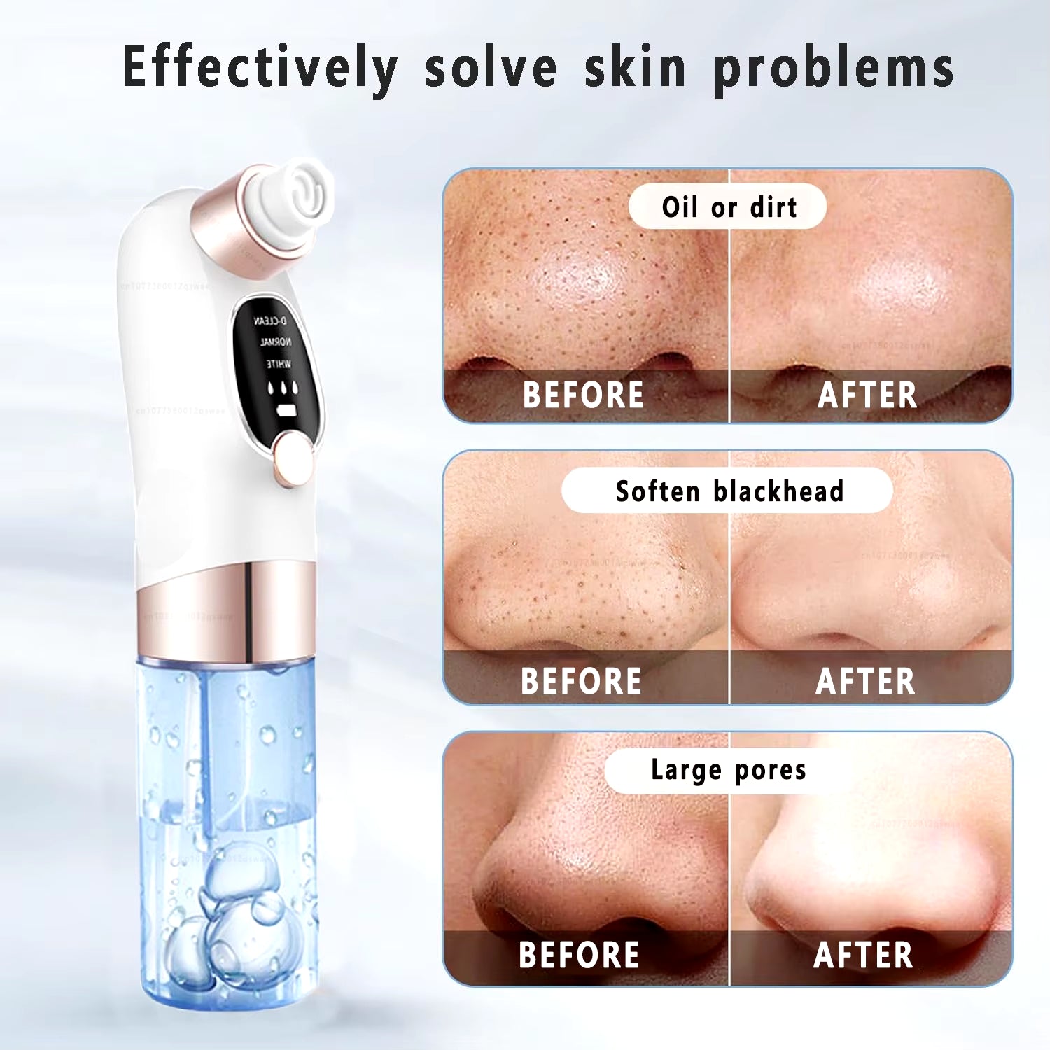 Blackhead Remover Pore Vacuum Face Cleaner Electric Pimple Acne Black Head Removal Rechargeable - EditWell
