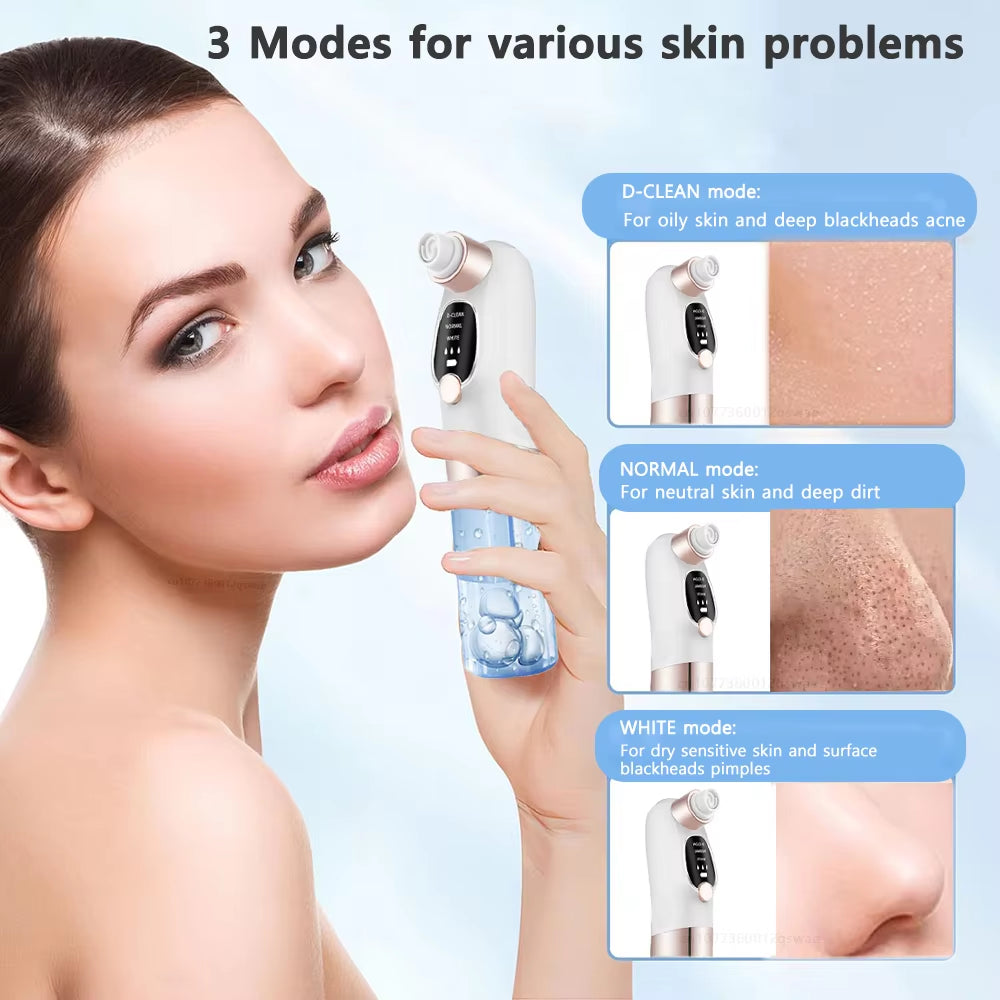 Blackhead Remover Pore Vacuum Face Cleaner Electric Pimple Acne Black Head Removal Rechargeable - EditWell