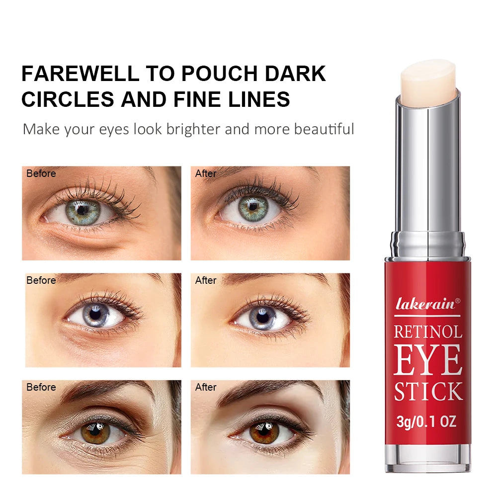 Retinol Eye Cream Stick | Dark Circles Firming | Instant Repair - EditWell