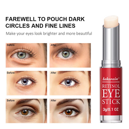 Retinol Eye Cream Stick | Dark Circles Firming | Instant Repair - EditWell