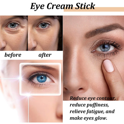 Snail Eye Cream Stick | Dark Circles Wrinkles Puffiness | Collagen - EditWell