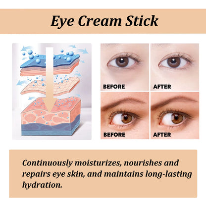 Snail Eye Cream Stick | Dark Circles Wrinkles Puffiness | Collagen - EditWell
