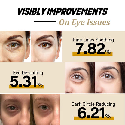 Snail Eye Cream Stick | Dark Circles Wrinkles Puffiness | Collagen - EditWell